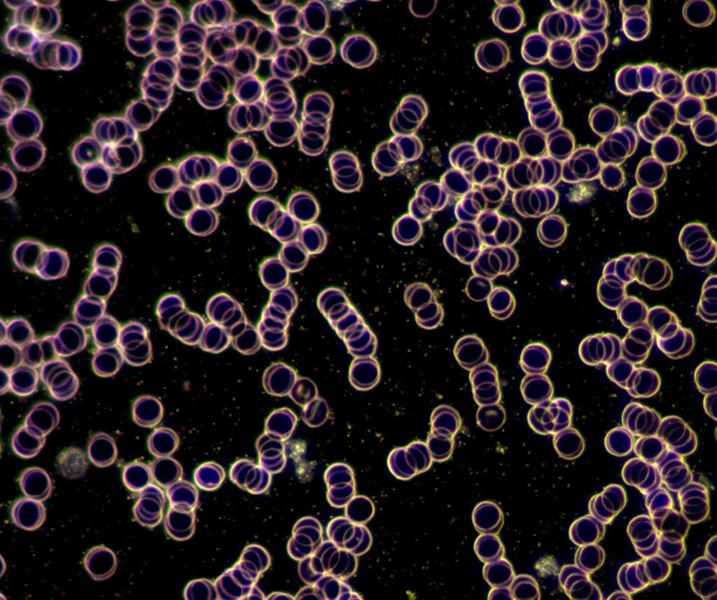 Dunkelfeldmikroskopie-Messung-nach-Magnetfeldtherapie-Detail-1024x857 in Magnetfeldtherapie