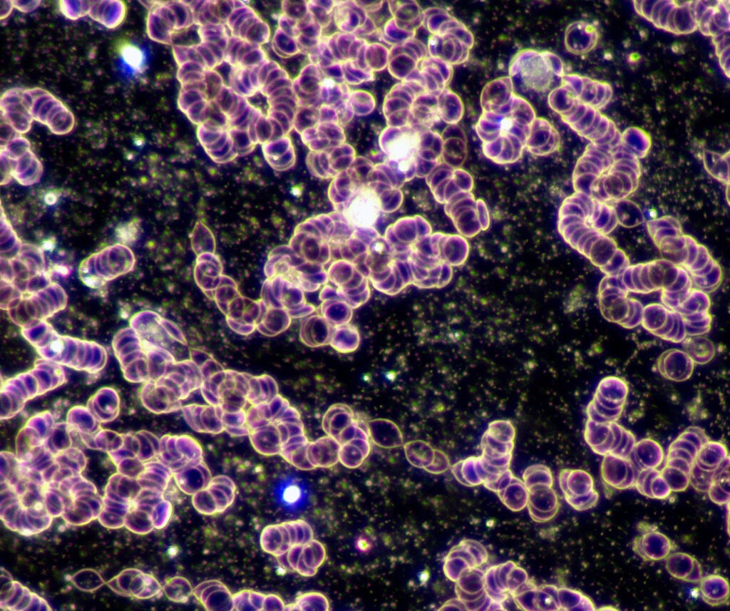 Dunkelfeldmikroskopie-Messung-vor-Magnetfeldtherapie-Detail-1024x857 in Magnetfeldtherapie