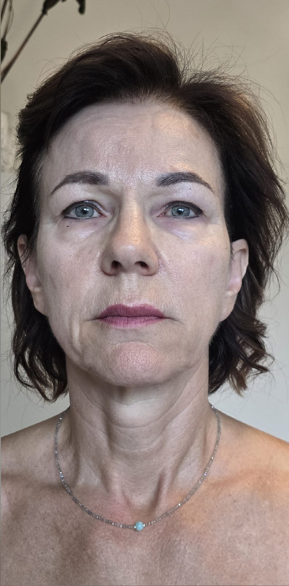 Phase-1-1 in Anti-Aging