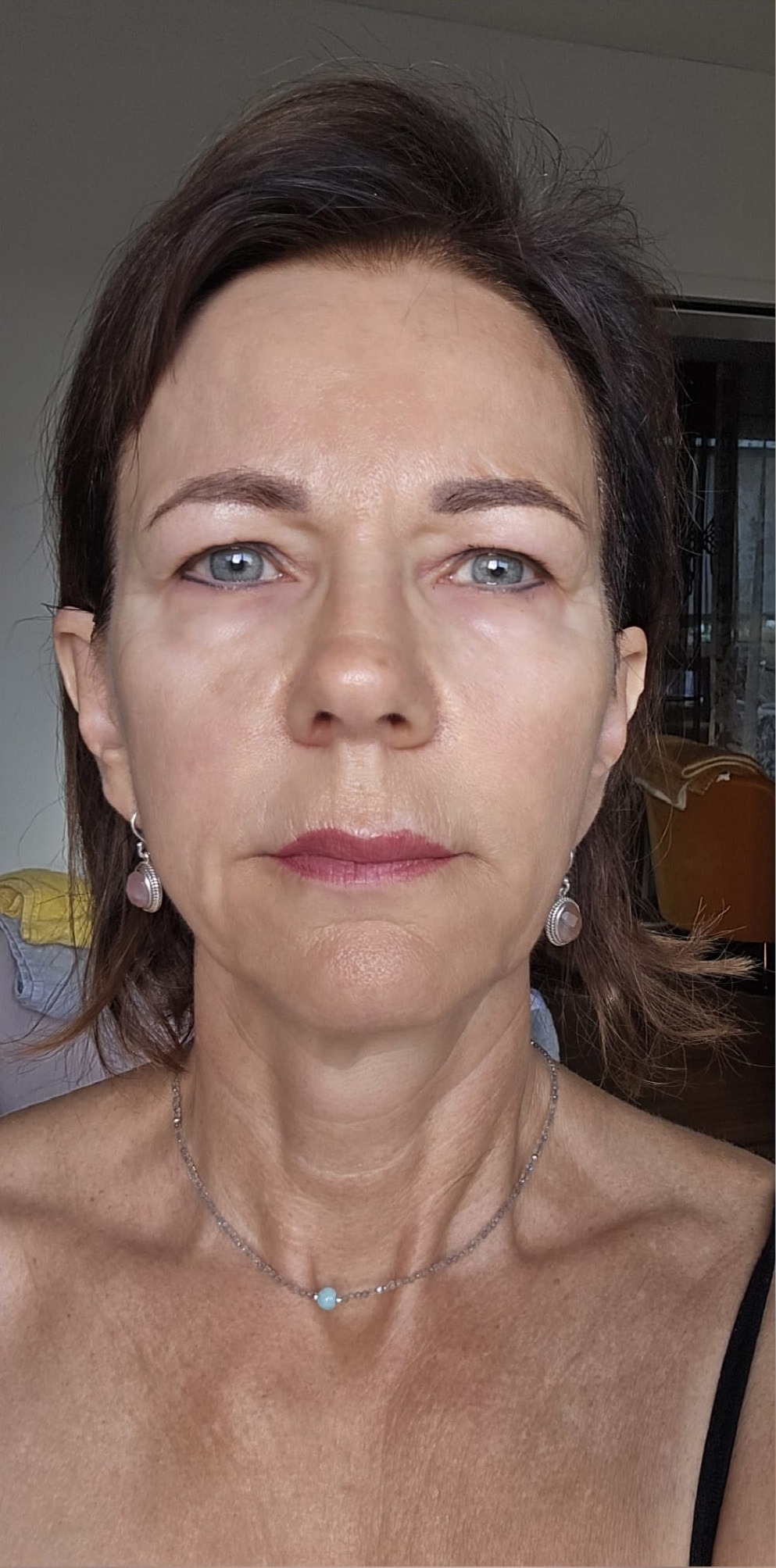 Phase-1-2 in Anti-Aging